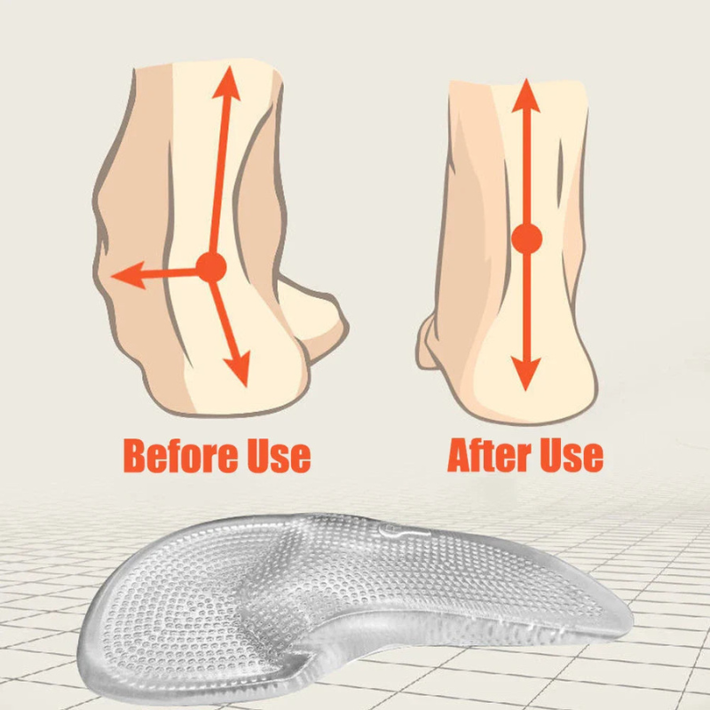 WW | Orthopädische Einlegesohlen Aus Silikon Gel