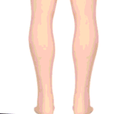 WW | Orthopädische Schuhe Für Damen