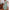 WW | Spitzen-Hollow-Patchwork-V-Ausschnitt-Kleid