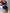 WW | Bikini Mit Hoher Taille